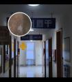 308准分子激光机种类